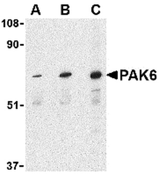 PAK6 Antibody