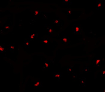 PAK6 Antibody