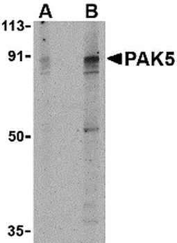 PAK7 Antibody