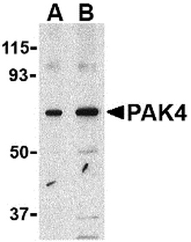 PAK4 Antibody