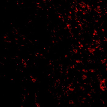 PAK4 Antibody
