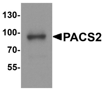 PACS2 Antibody