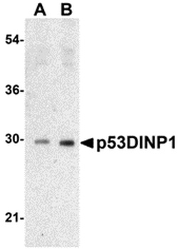 p53DINP1 Antibody
