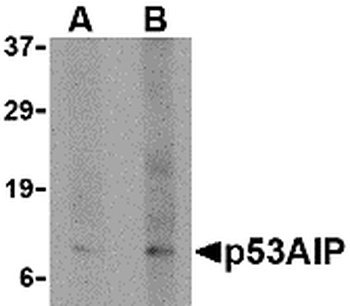TP53AIP1 Antibody