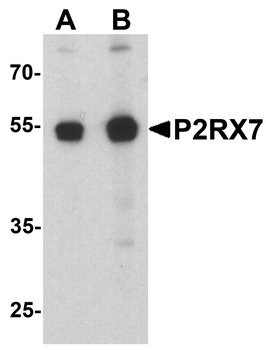P2RX7 Antibody