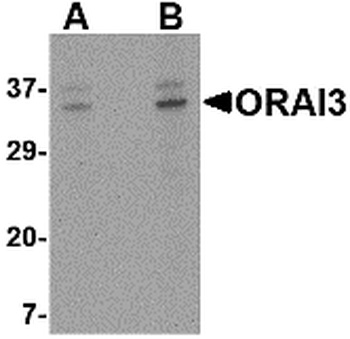 ORAI3 Antibody