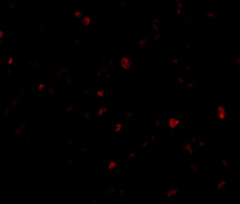 ORAI3 Antibody