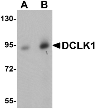 DCLK1 Antibody