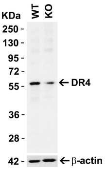 TNFRSF10A Antibody