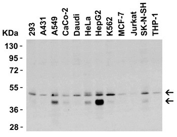 TNFRSF10B Antibody