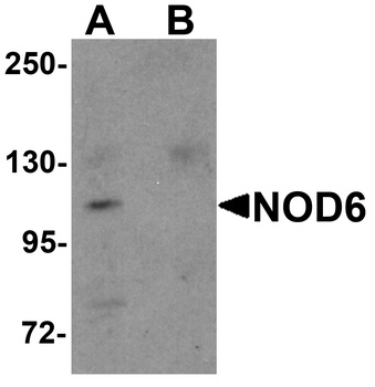 NOD6 Antibody