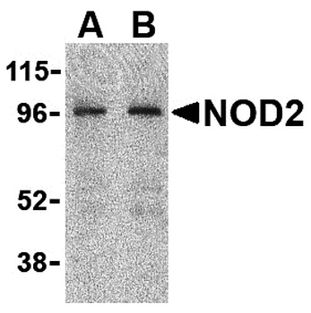 NOD2 Antibody