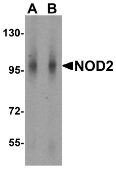 NOD2 Antibody