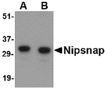NIPSNAP1 Antibody