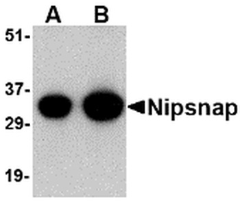 NIPSNAP1 Antibody