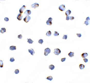 MAP3K14 Antibody