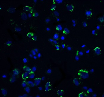 MAP3K14 Antibody