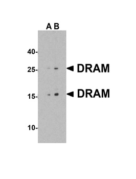 DRAM1 Antibody