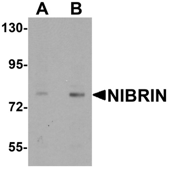 NBN Antibody