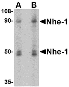 SLC9A1 Antibody