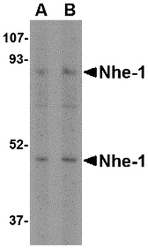 SLC9A1 Antibody