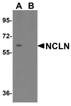 NCLN Antibody