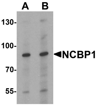 NCBP1 Antibody
