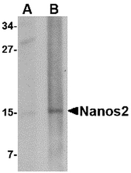 NANOS2 Antibody