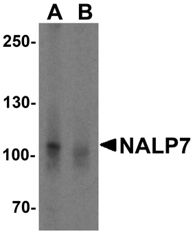 NALP7 Antibody