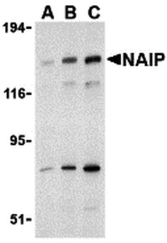 NAIP Antibody
