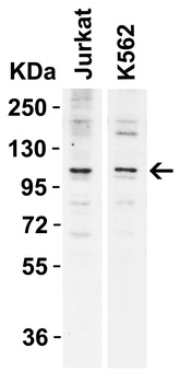 N4BP1 Antibody