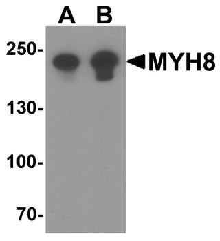 MYH8 Antibody