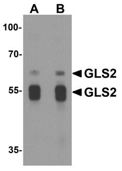GLS2 Antibody