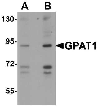 GPAT1 Antibody
