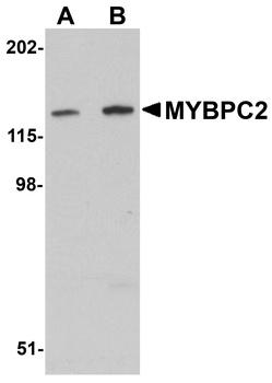 MYBPC2 Antibody