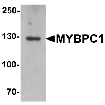 MYBPC1 Antibody