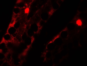 MTERFD2 Antibody