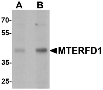 MTERFD1 Antibody