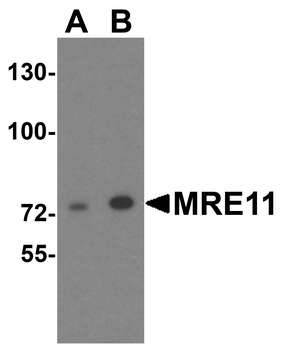 MRE11A Antibody
