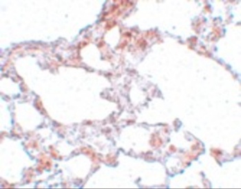 MRE11A Antibody