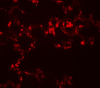 MRE11A Antibody