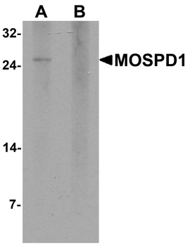 MOSPD1 Antibody