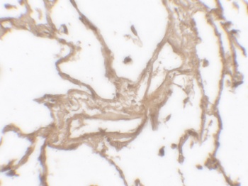 MMP9 Antibody