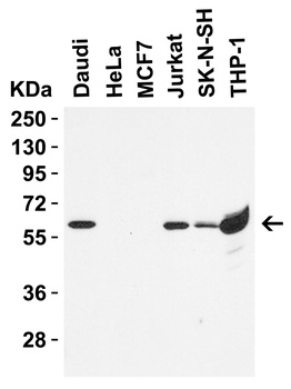 hRIP3 Antibody