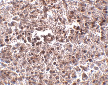 METTL7B Antibody