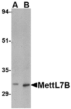 MettL7B Antibody