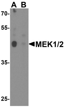 MAP2K1 Antibody