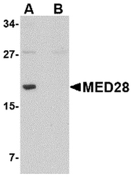 MED28 Antibody