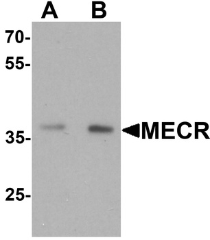 MECR Antibody