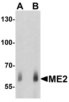 ME2 Antibody